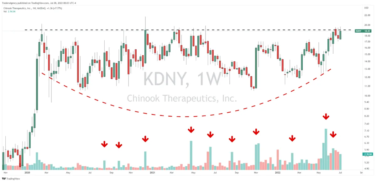 With a Setup Like This, I’m Expecting Big Things From Chinook Therapeutics