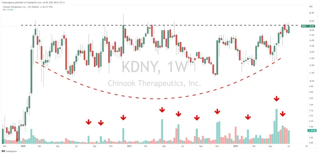 With a Setup Like This, I’m Expecting Big Things From Chinook Therapeutics